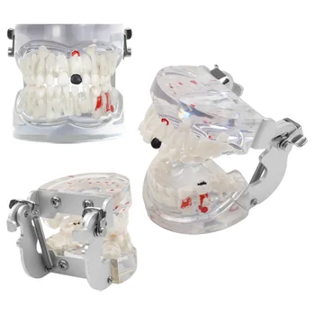 Модел на зъбите при по дентална патология за студенти, изучаващи Подвижни стоматологични материали, Стоматологична инструмент